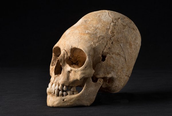 Ученые объяснили природу "вытянутых" черепов у древних инков