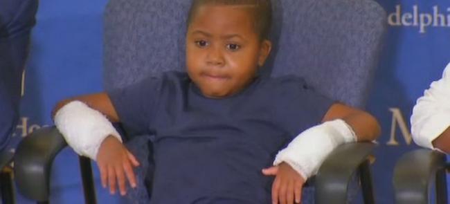 Врачи в США пересадили кисти рук восьмилетнему мальчику (видео)