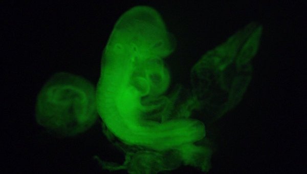 У человеческих эмбрионов нашли неизвестный орган