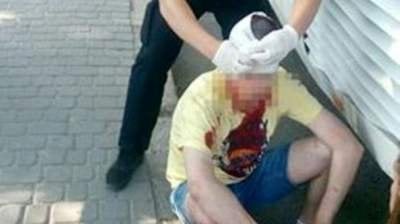 Во Львове турист из Польши разбил голову во время приступа эпилепсии