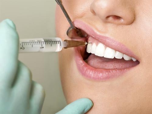 Какие стоматологические услуги пользуются наибольшей популярностью