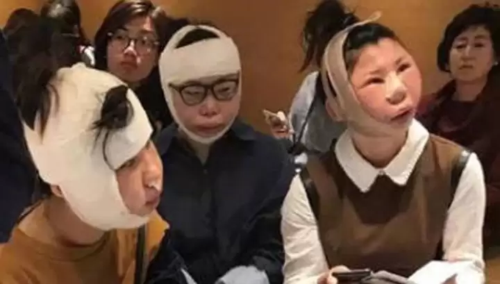 Китаянок не пустили на батьківщину через розпухлі після пластики обличчя 