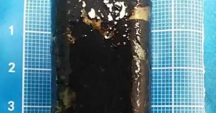 Вона все ще працювала: чоловік прожив 30 років із запальничкою у шлунку Вона все ще працювала: чоловік прожив 30 років із запальничкою у шлунку